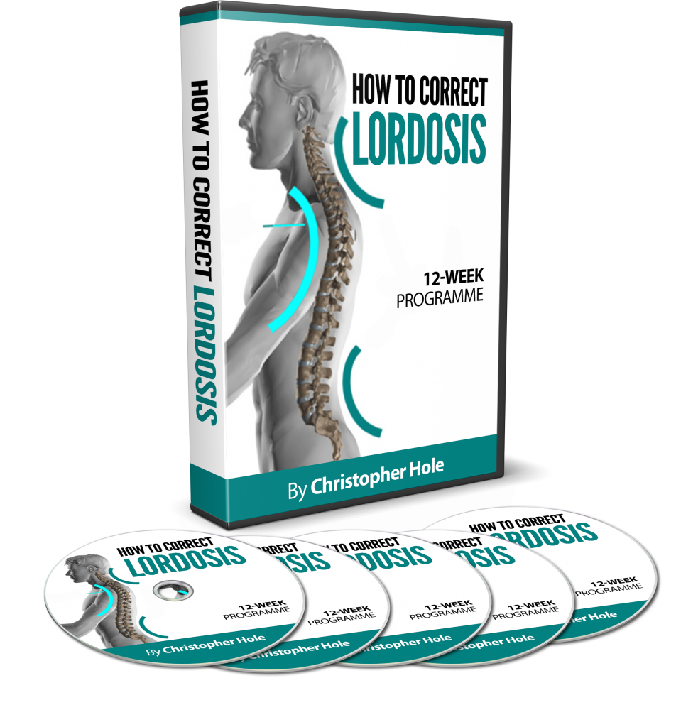 lordosis