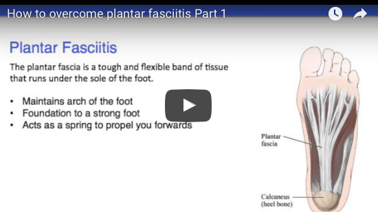 plantar fasciitis